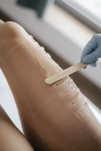 Epilon depilacja laserowa Gdynia